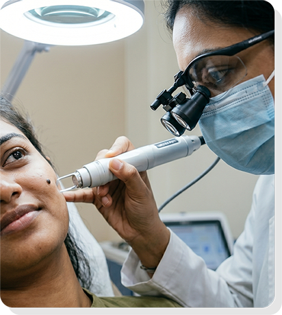 Mole & Skin Tag Removal